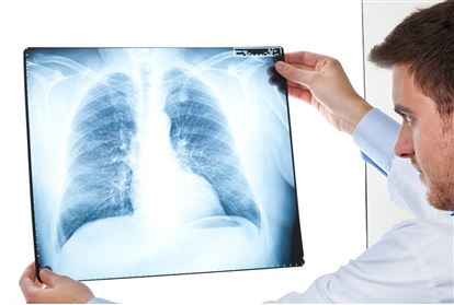 Đèn xem phim Xquang - Khay chứa phim